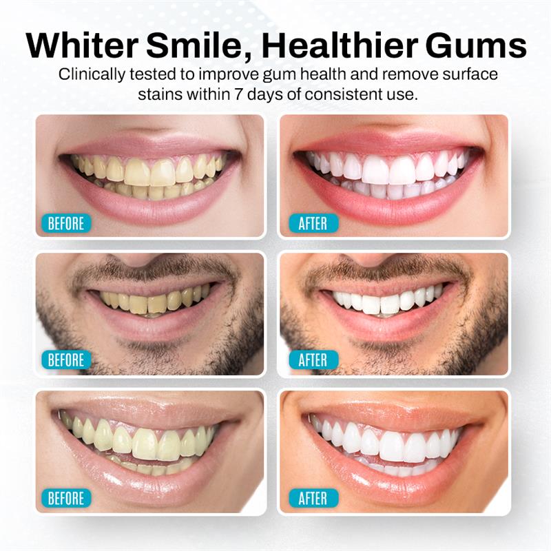 Seurico™ Bright Clean