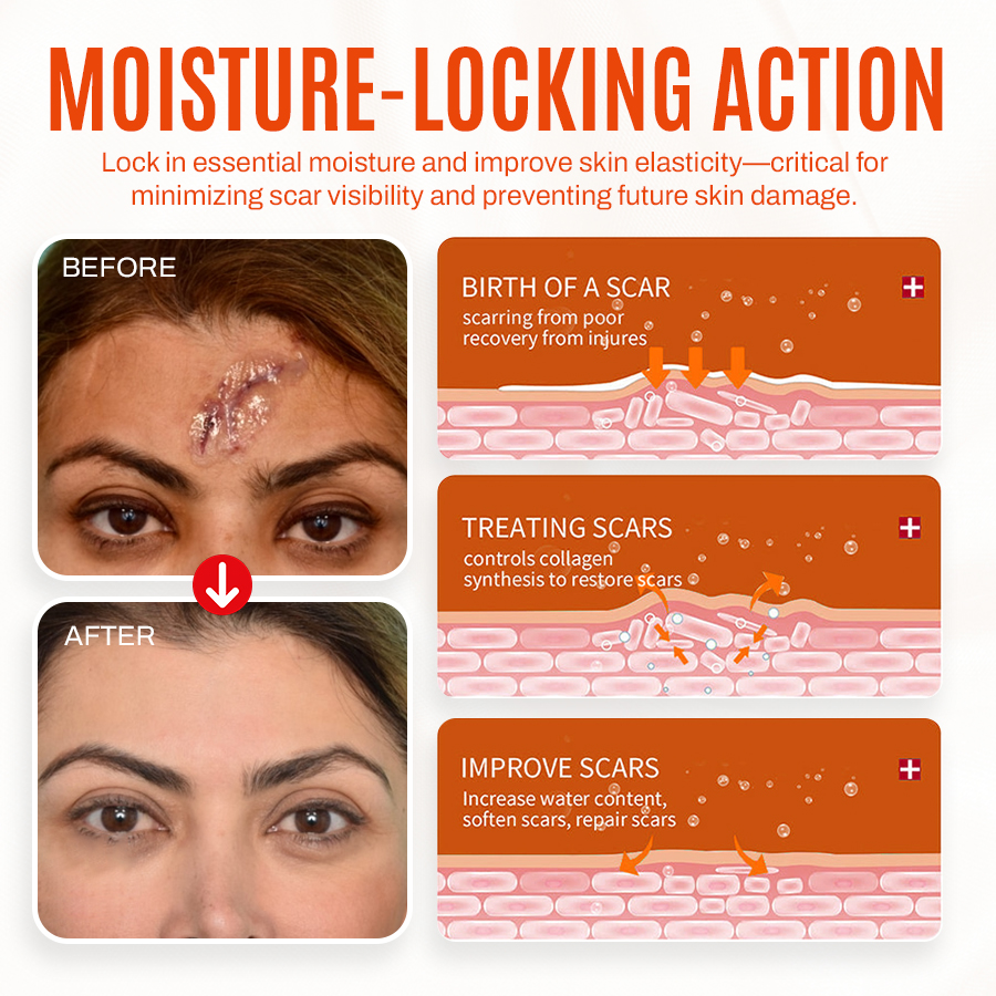 🔥Seurico™ Advanced scar killer gel