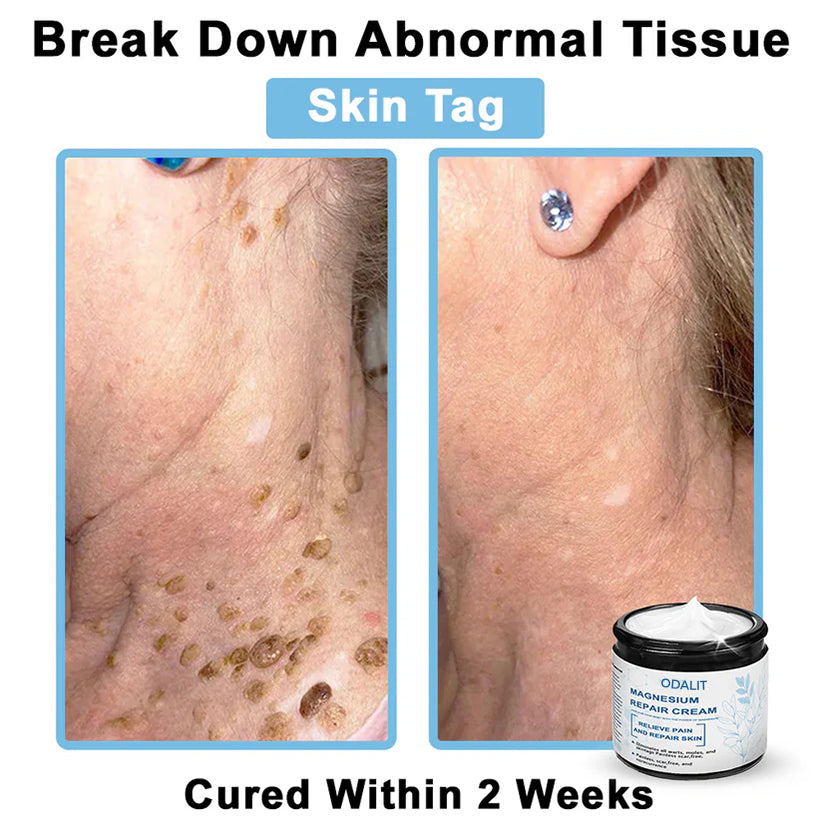 🏆✅Mayo Clinic Official: Magnesium skin repair cream (Eczema and Psoriasis Relief, Skin Repair, Even Tone, Acne and Dark Spot Treatment, Wart and Mole Removal)