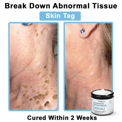 🏆✅Mayo Clinic Official: Magnesium skin repair cream (Eczema and Psoriasis Relief, Skin Repair, Even Tone, Acne and Dark Spot Treatment, Wart and Mole Removal)