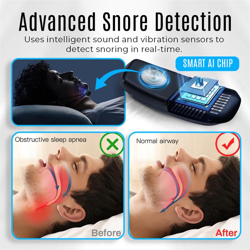 Seurico™ Smart Pulse Anti-Snore Device