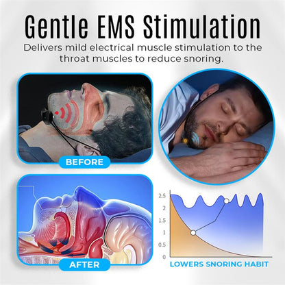 Seurico™ Smart Pulse Anti-Snore Device