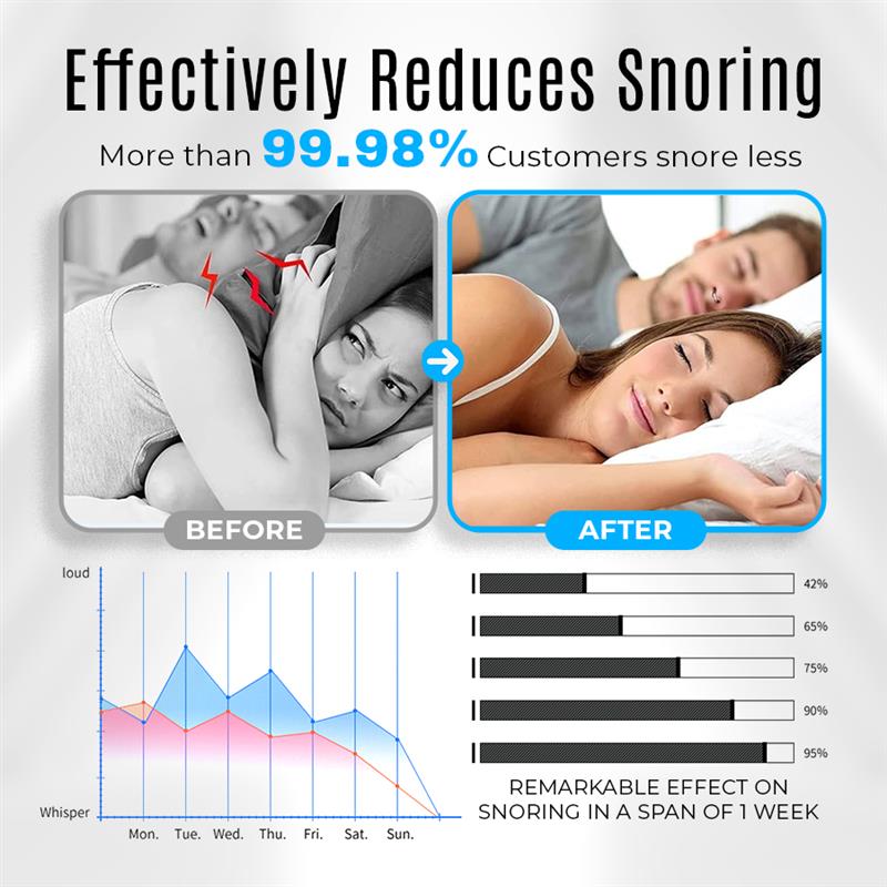 Seurico™ Smart Pulse Anti-Snore Device