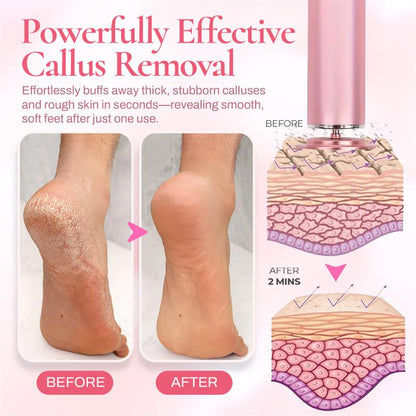 Seurico™ FootSoft 2.0