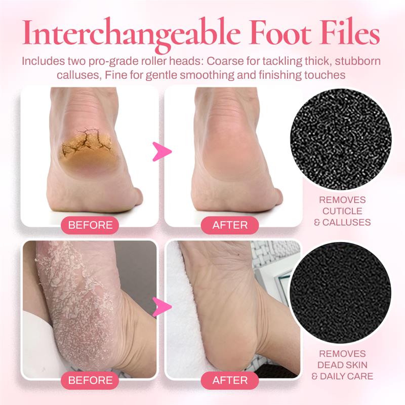 Seurico™ FootSoft 2.0