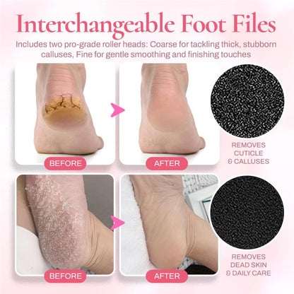 Seurico™ FootSoft 2.0