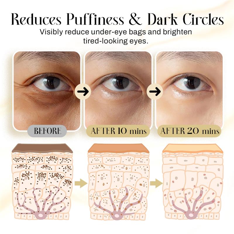 Radiant Eye Microcurrent Lift Patches