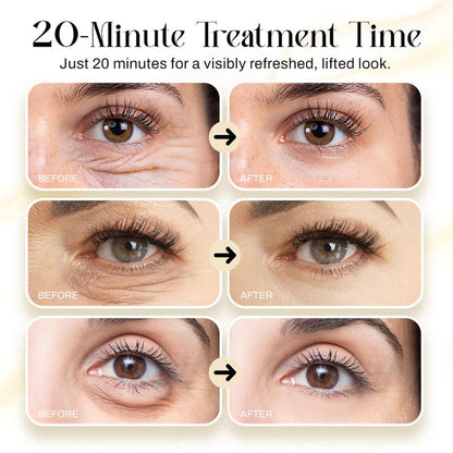Radiant Eye Microcurrent Lift Patches
