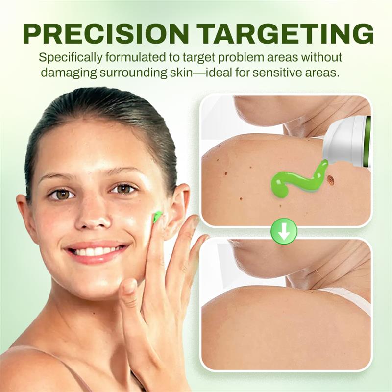 Seurico™ Fast Mole & Spot Removal Cream