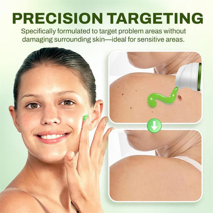 Seurico™ Fast Mole & Spot Removal Cream