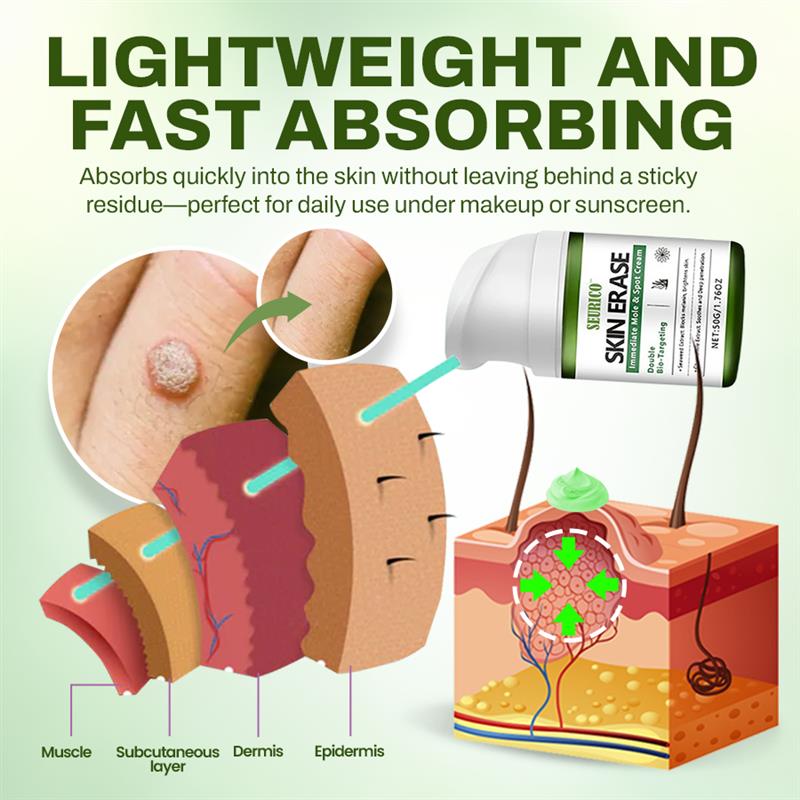 Seurico™ Fast Mole & Spot Removal Cream