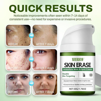 Seurico™ Fast Mole & Spot Removal Cream