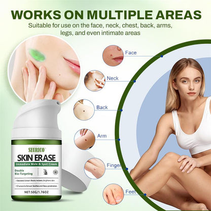 Seurico™ Fast Mole & Spot Removal Cream