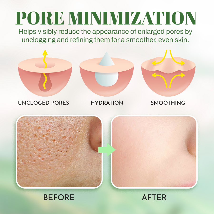 🔥NEGUSY™ Skin Purifying Breath Stick