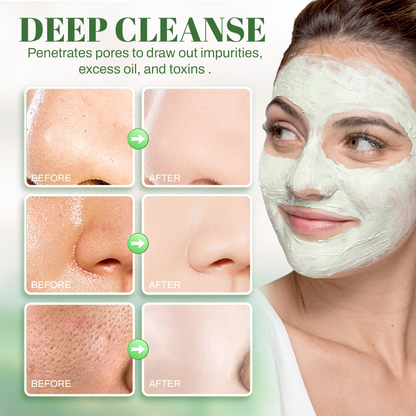 🔥NEGUSY™ Skin Purifying Breath Stick