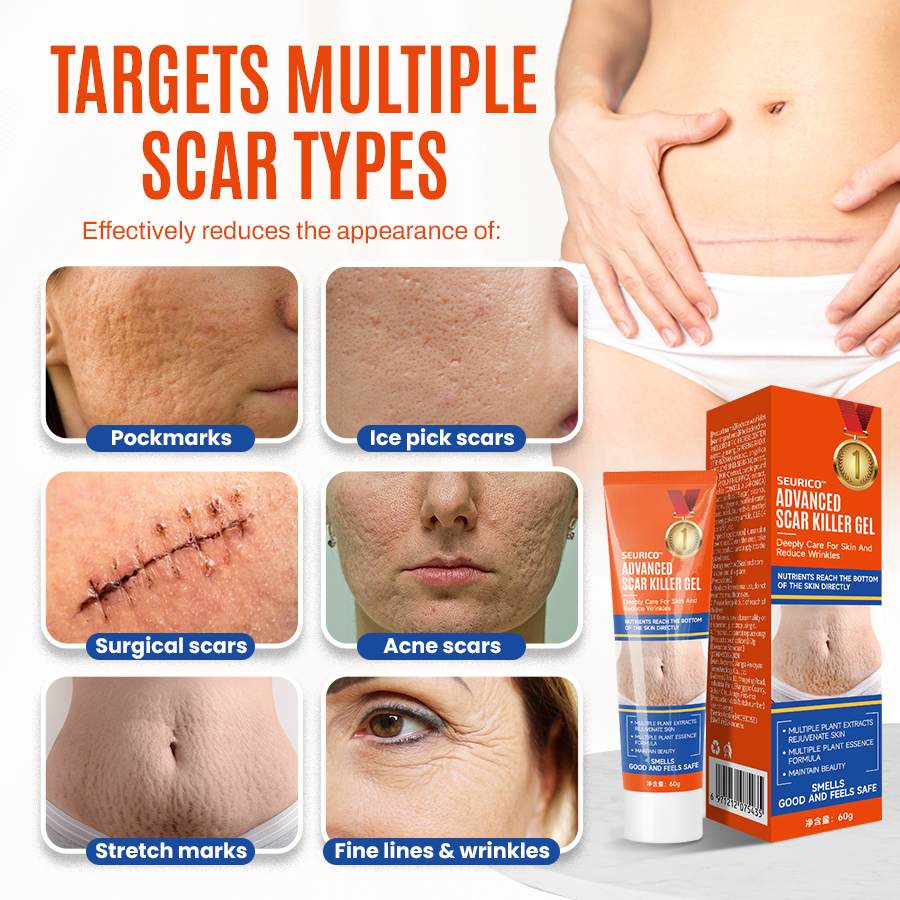 🔥Seurico™ Advanced scar killer gel