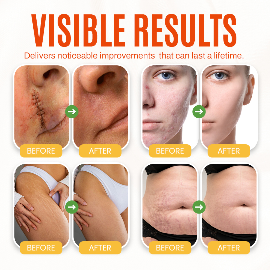 🔥Seurico™ Advanced scar killer gel