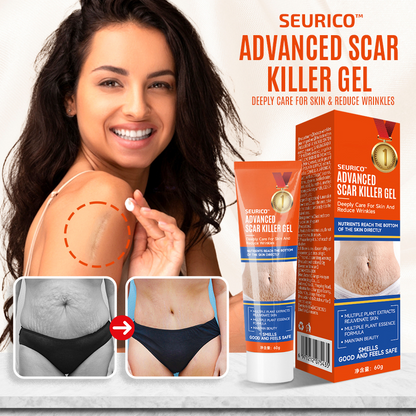 🔥Seurico™ Advanced scar killer gel