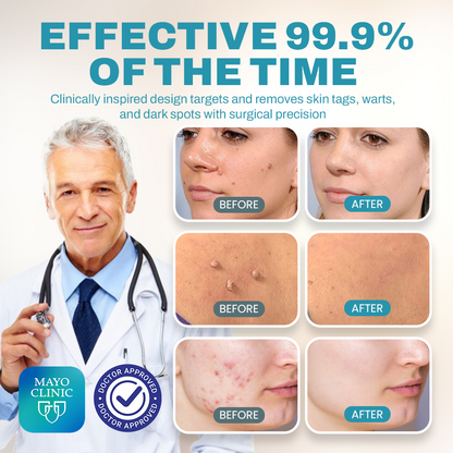 🔥NEGUSY™ CO₂ Laser Precision Pen: Advanced Mole & Wart Removal