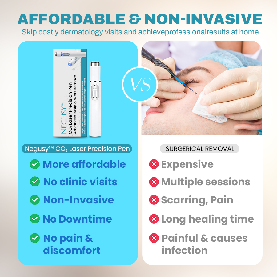 🔥NEGUSY™ CO₂ Laser Precision Pen: Advanced Mole & Wart Removal