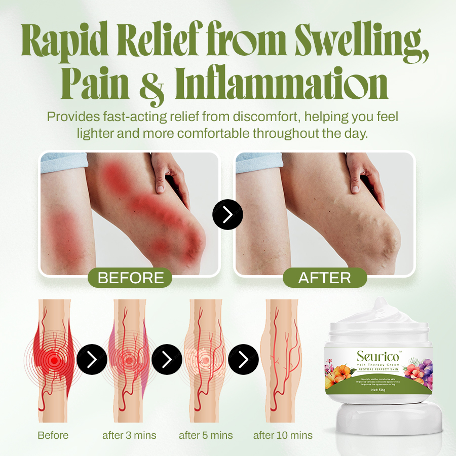 🍃Seurico™ Vein Relief Cream🍃