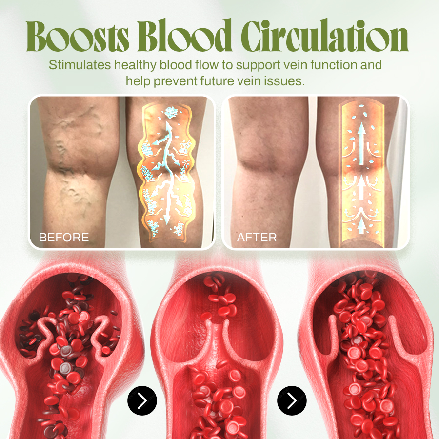 🍃Seurico™ Vein Relief Cream🍃