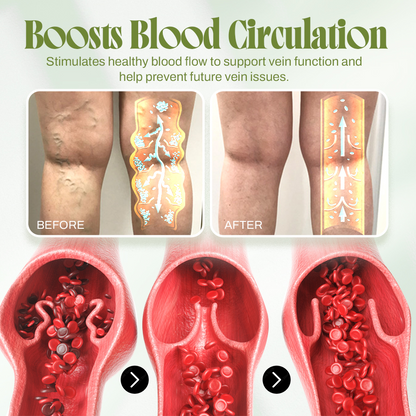 🍃Seurico™ Vein Relief Cream🍃