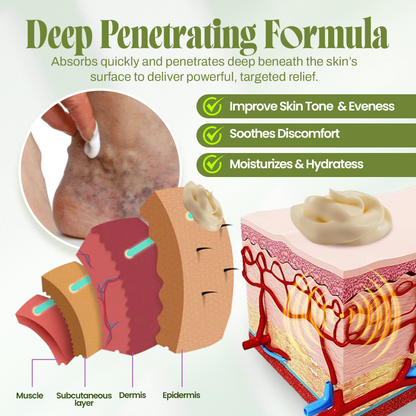 🍃Seurico™ Vein Relief Cream🍃