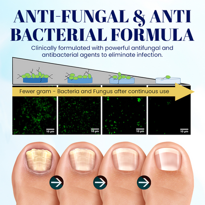 NEGUSY™ Nail Onycholysis Treatment