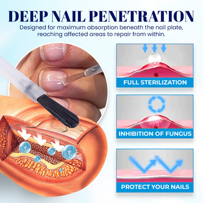 NEGUSY™ Nail Onycholysis Treatment