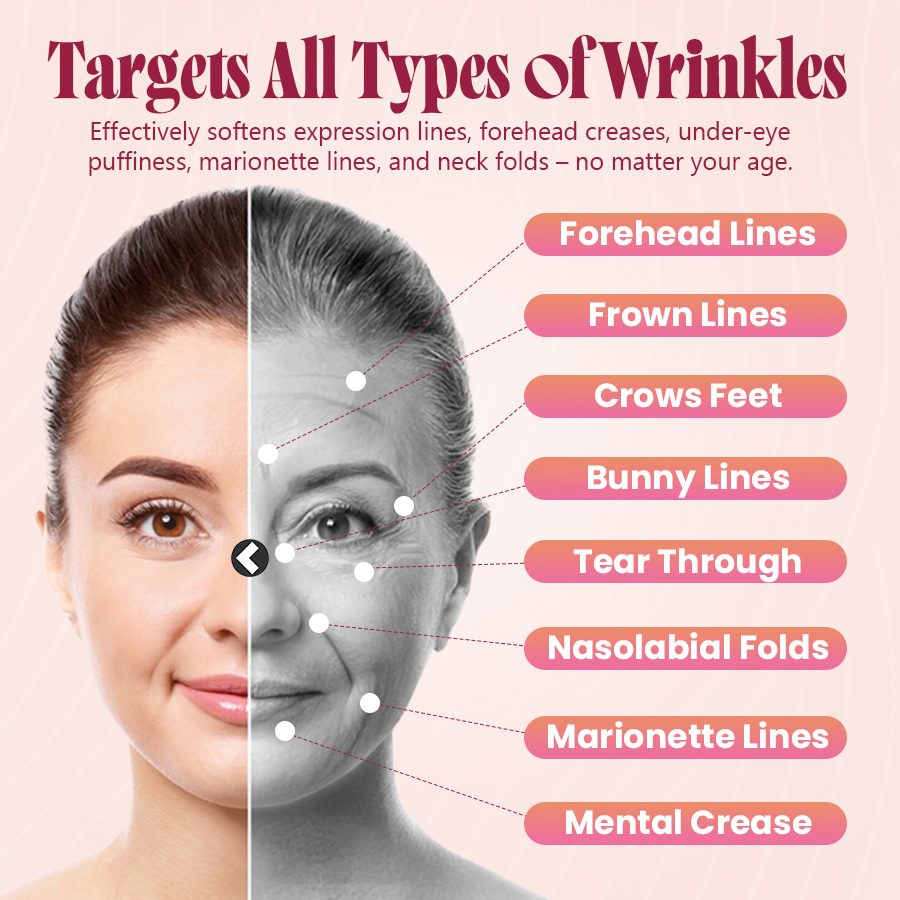 Last Day Discount: 87% OFF 🌸 Second Gen Instant Wrinkle Eraser 🌟