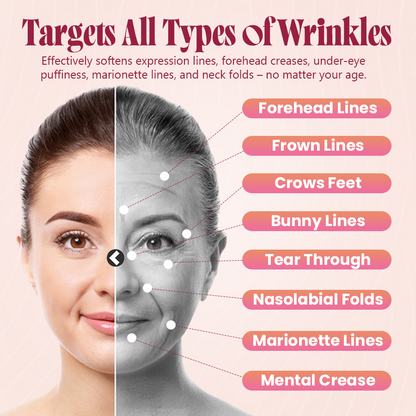 Last Day Discount: 87% OFF 🌸 Second Gen Instant Wrinkle Eraser 🌟