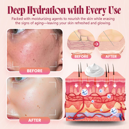 Last Day Discount: 87% OFF 🌸 Second Gen Instant Wrinkle Eraser 🌟