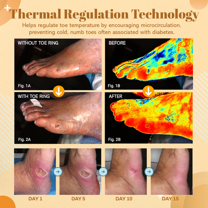 NEGUSY™ Sugar Control Toe Rings