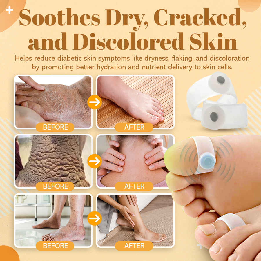 NEGUSY™ Sugar Control Toe Rings