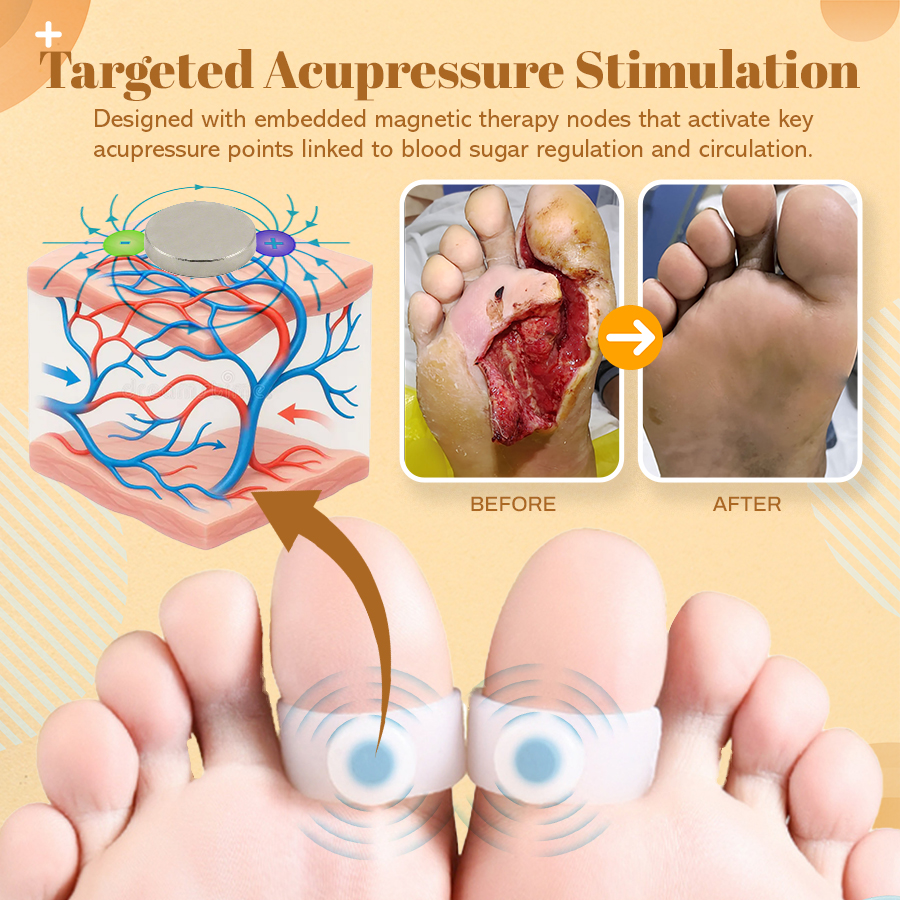 NEGUSY™ Sugar Control Toe Rings