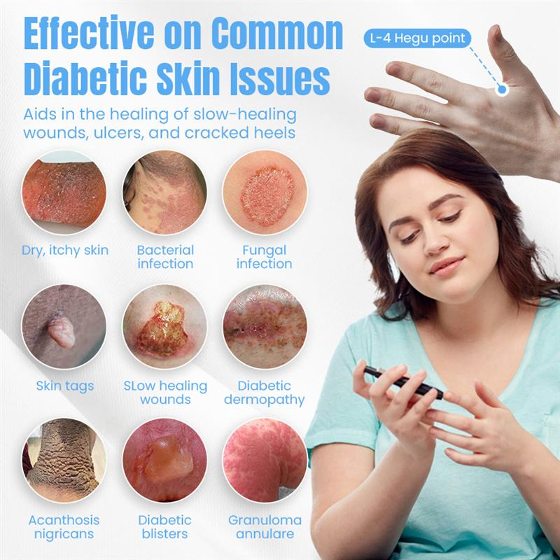 NEGUSY™ Sugar Control Acupressure Point Clip