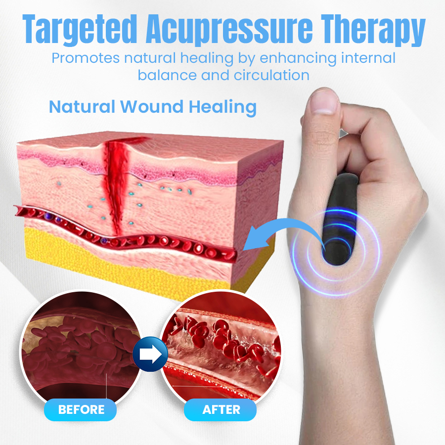 NEGUSY™ Sugar Control Acupressure Point Clip