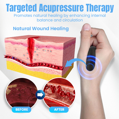 NEGUSY™ Sugar Control Acupressure Point Clip