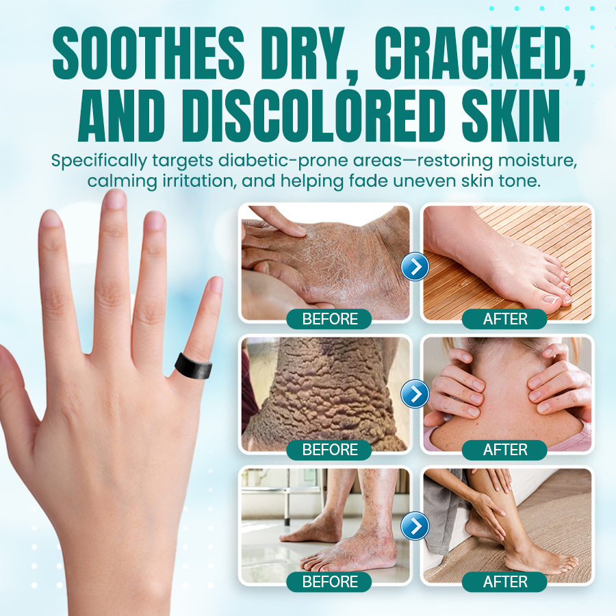 NEGUSY™ Sugar Control Magnetic Ring