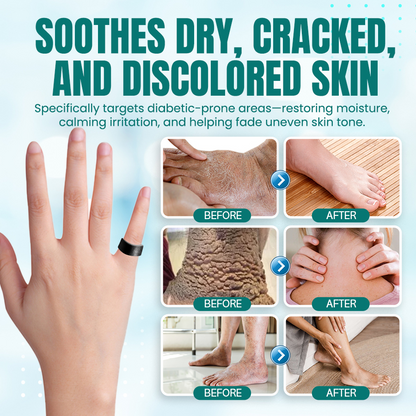 NEGUSY™ Sugar Control Magnetic Ring