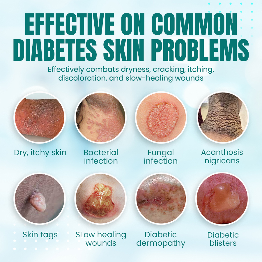 NEGUSY™ Sugar Control Magnetic Ring