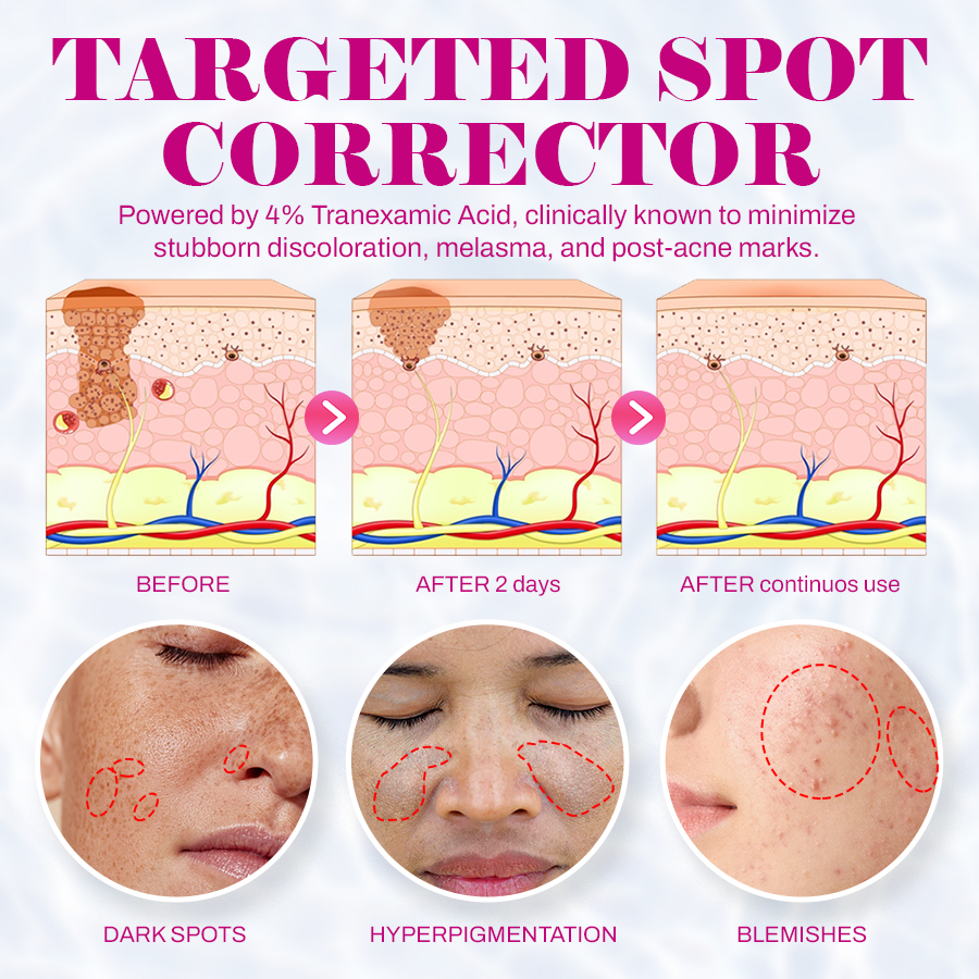 Revive Cream: Abutin 7% + Traneaxamic Acid 4%