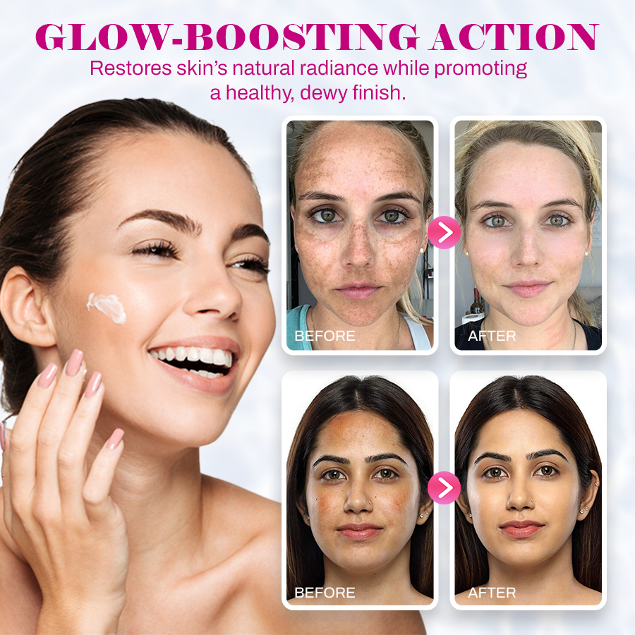 Revive Cream: Abutin 7% + Traneaxamic Acid 4%