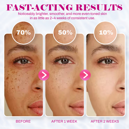 Revive Cream: Abutin 7% + Traneaxamic Acid 4%