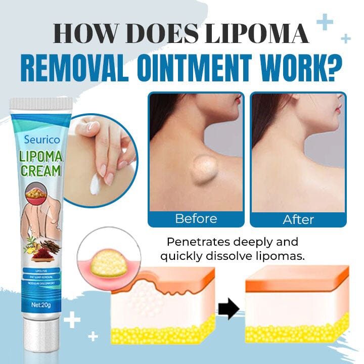 Seurico™ Lipoma Removal Ointment