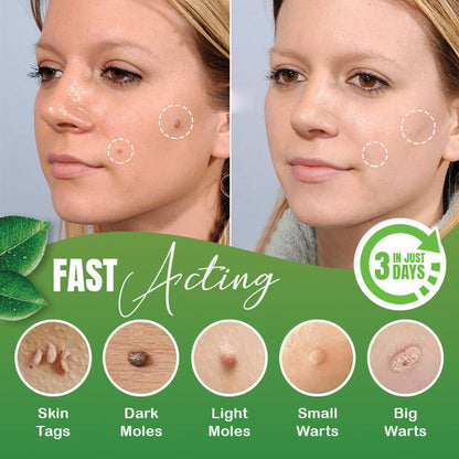 Skin Tag/warts Herbal Removal Patch
