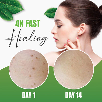 Skin Tag/warts Herbal Removal Patch