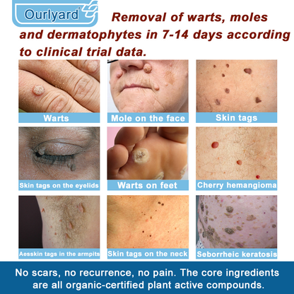 ✅Mayo Clinic Official: Magnesium skin repair cream (Eczema and Psoriasis Relief, Skin Repair, Even Tone, Acne and Dark Spot Treatment, Wart and Mole Removal)