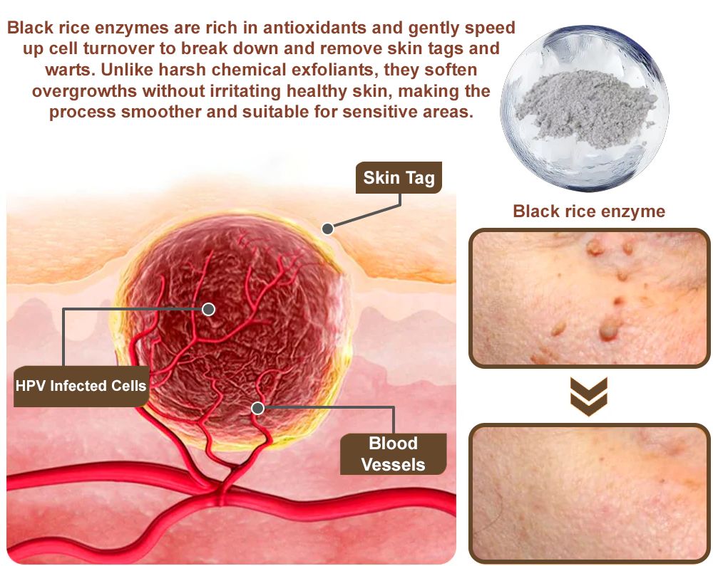 Black Rice Skin Repair Essence Cream 👨‍⚕️ FDA Certified (Removes warts and skin growths, improves keratin buildup and seborrheic dermatitis, follicular keratosis, age spots, and bruising)